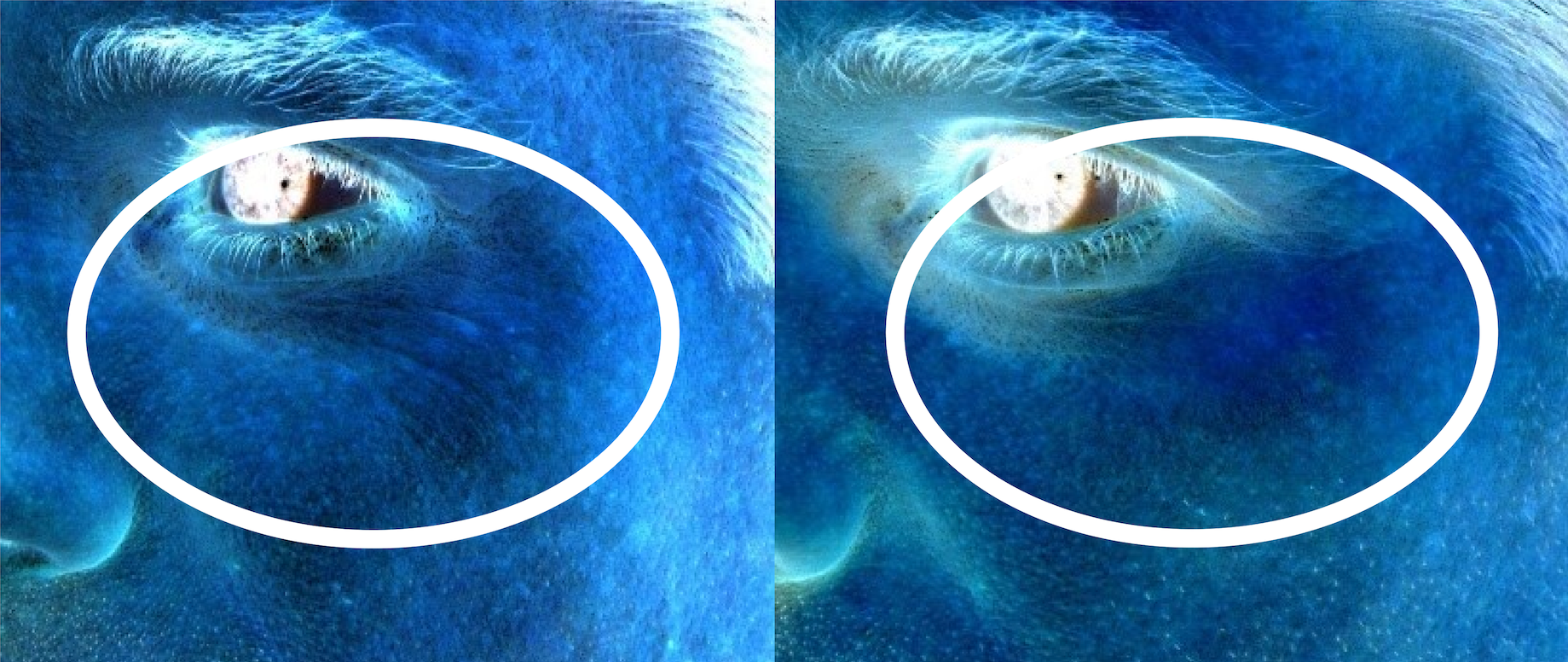 nanofrequency before and after male